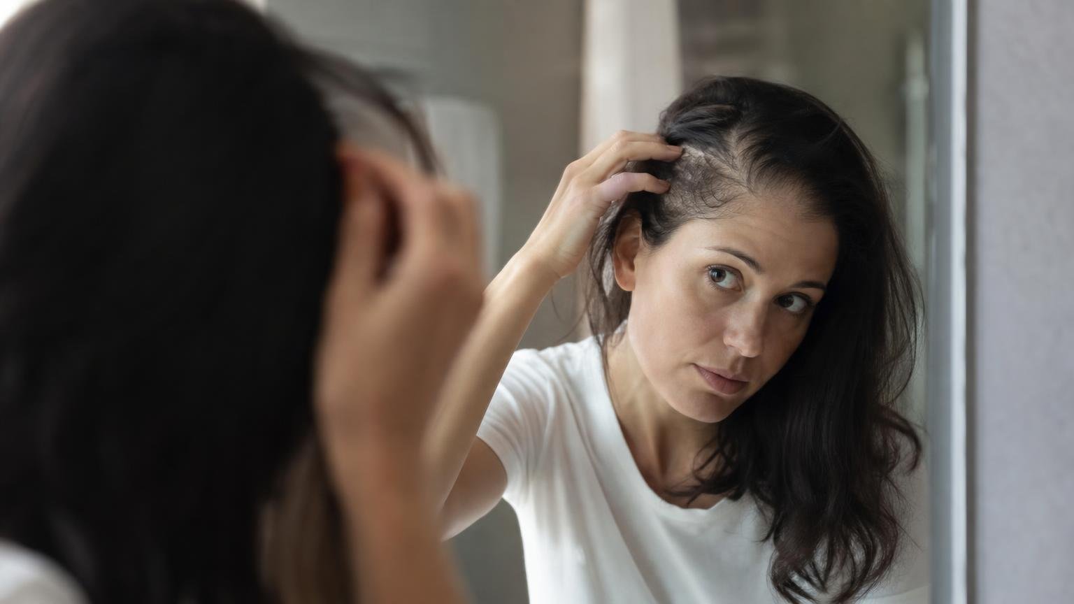 Alopécie : un traitement de lʼarthrite fait repousser les cheveux en six mois selon une étude