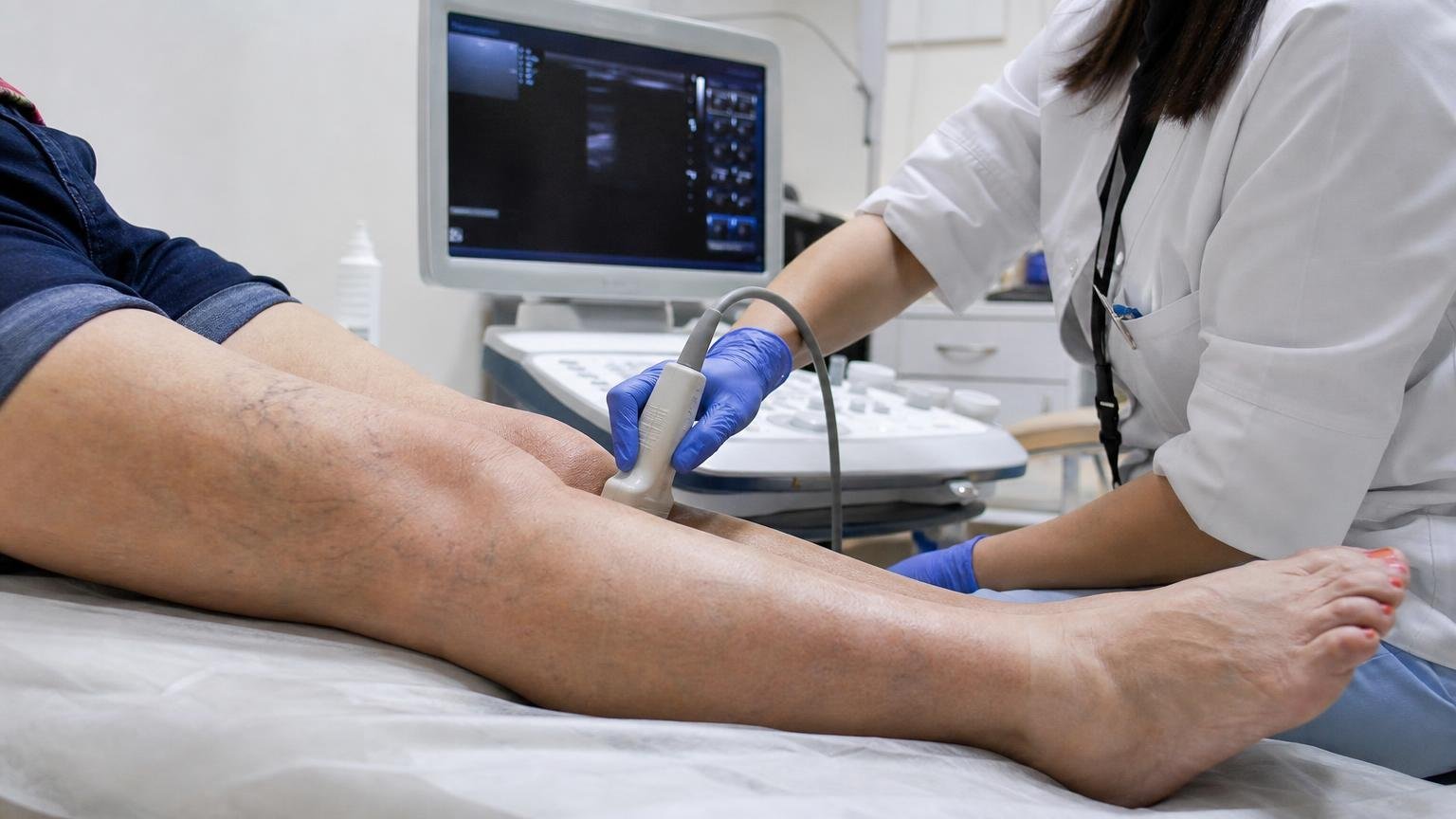 Des mollets qui gonflent le soir après 60 ans doivent faire écouter les veines