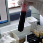 A close-up of a laboratory technician's hand holding a test tube fi…